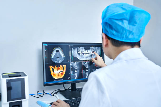 Best Knocked-Out Tooth (Avulsed Tooth) Treatment in Peru, IL